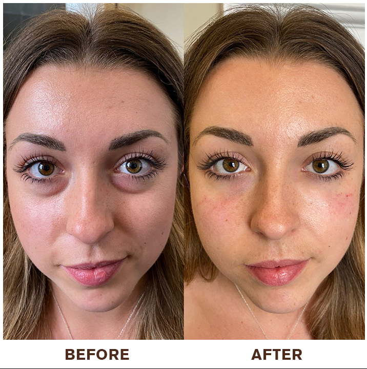 LIMETOW® Instant Eye Cream Tightener✨