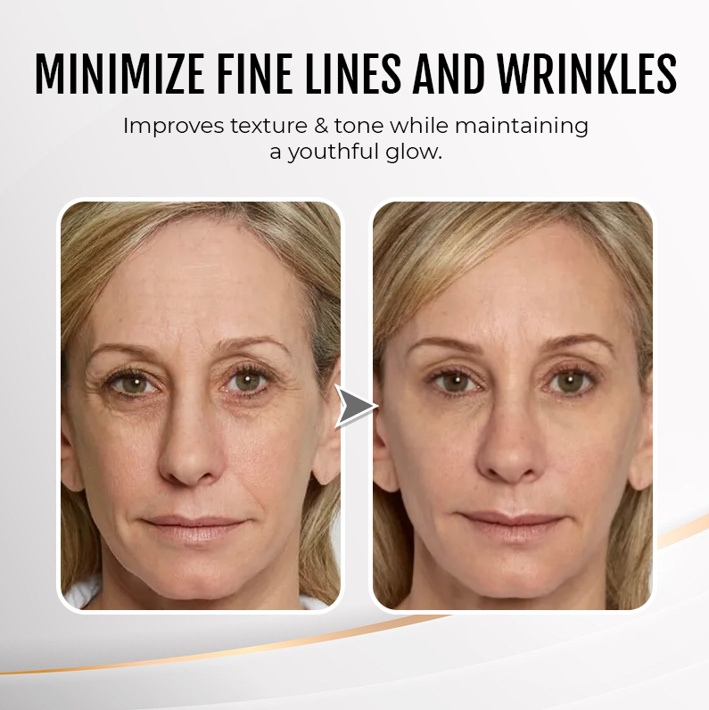 LIMETOW® Instant Eye Cream Tightener✨