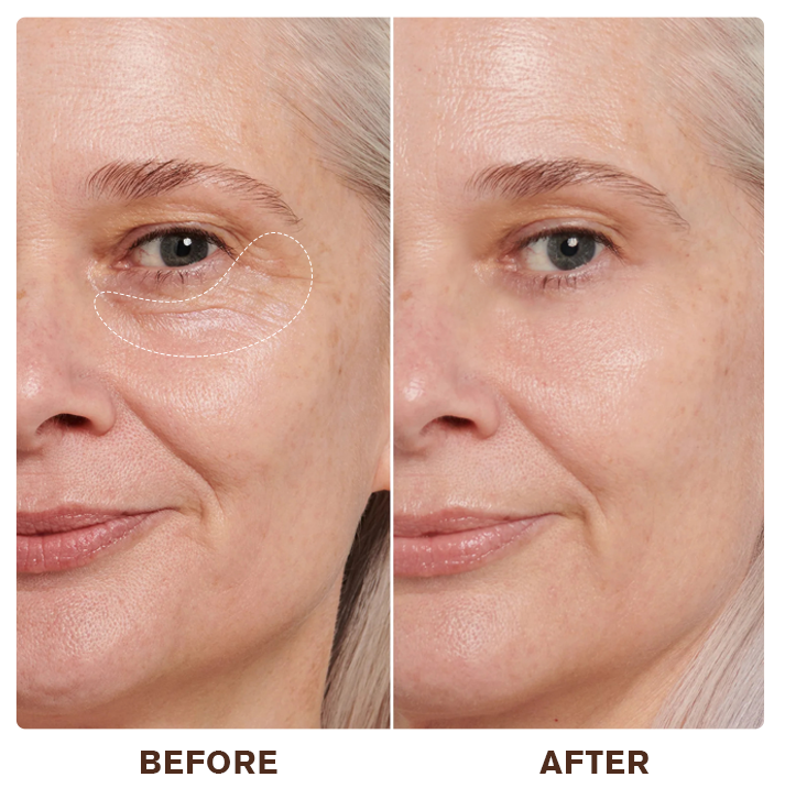 LIMETOW® Instant Eye Cream Tightener✨