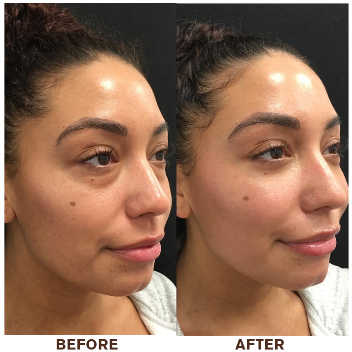 LIMETOW® Instant Eye Cream Tightener✨