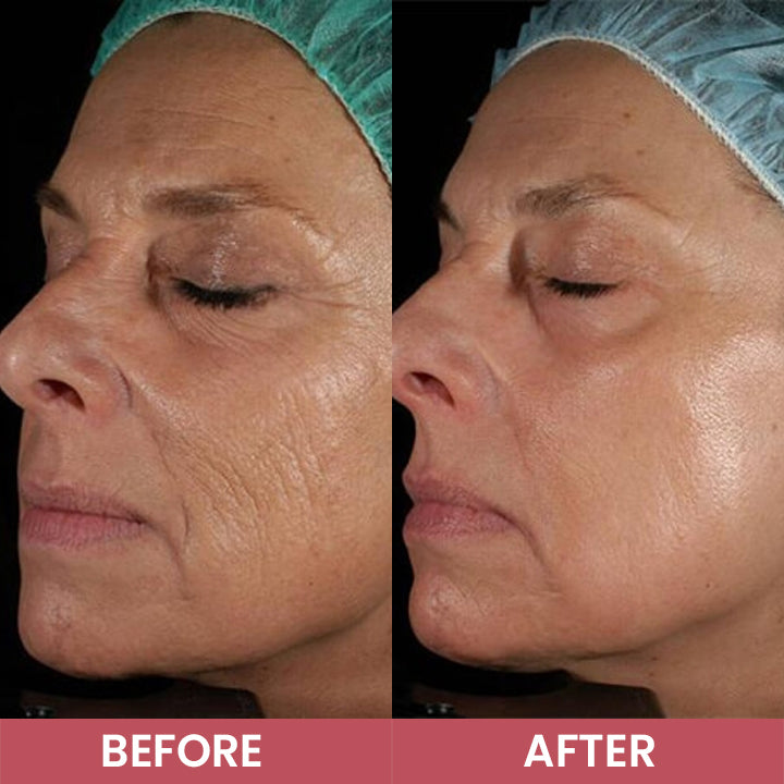 LIMETOW® Compact Anti-Wrinkle Bar