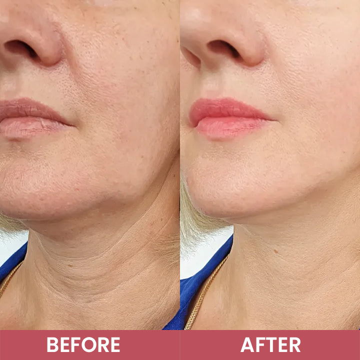 LIMETOW® Compact Anti-Wrinkle Bar